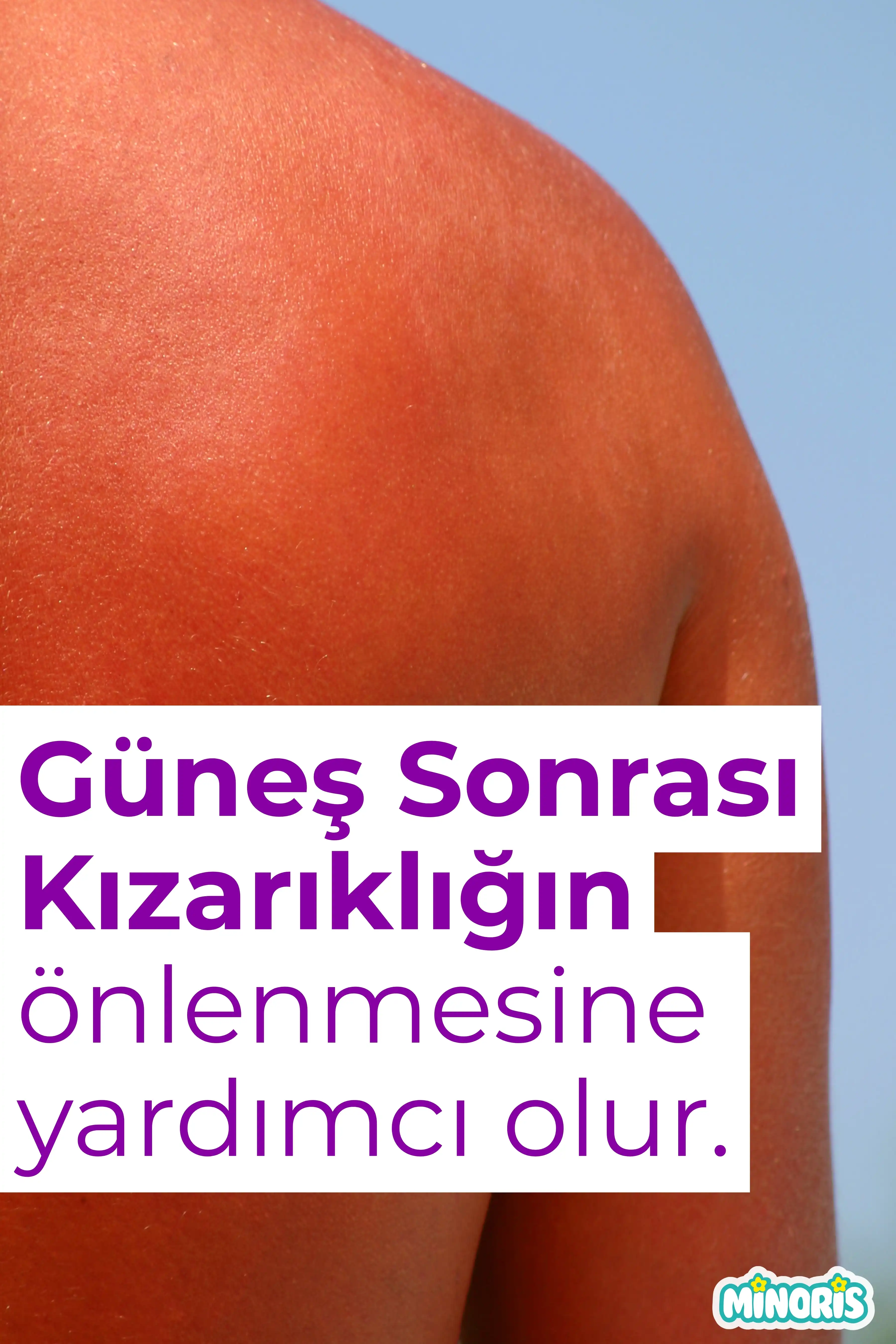 Minoris Mom Organik After Sun Sprey ve Güneş Sonrası Yoğun Nemlendirici 100 ml